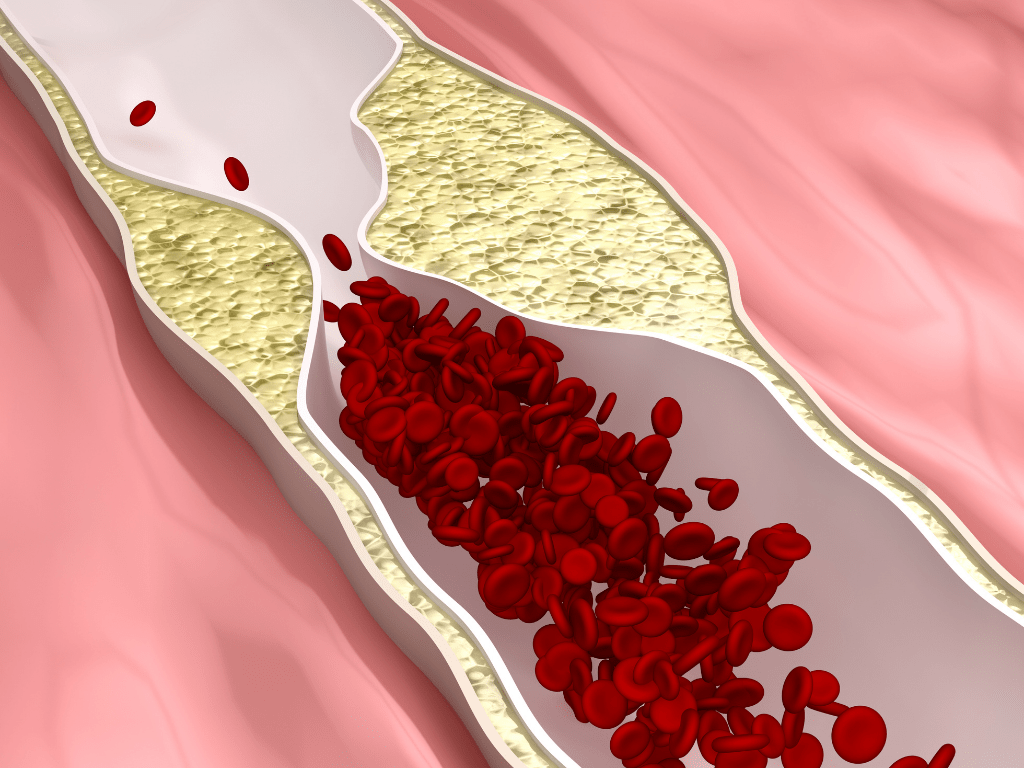 PULS Cardiac Testing